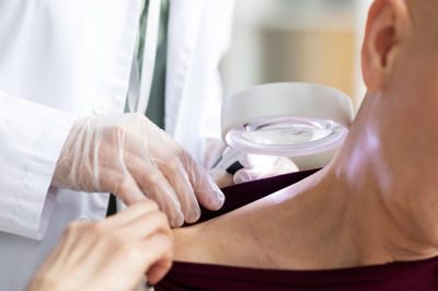 Онколог Каприн: новообразования на коже могут сигнализировать о раке кожи